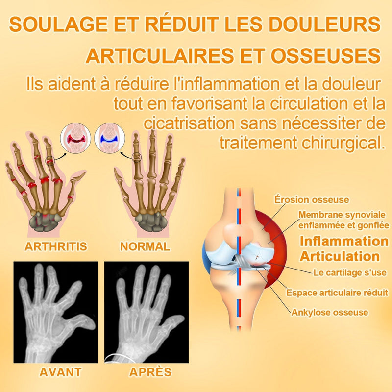 SootheJoint | Crème Apaisante au Venin d'Abeille - 1+1 GRATUIT