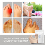 BunionGone™ Correcteur orthopédique d'hallux valgus